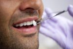 Avantajele si dezavantajele fatetelor dentare