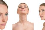 Lifting facial fără intervenție chirurgicală    