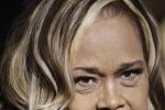 C&acirc;ntăreaţa Etta James, diagnosticată cu demenţă şi leucemie.
