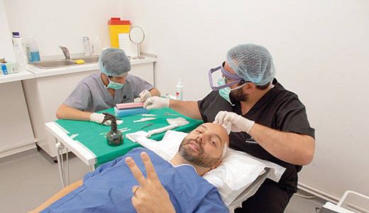 Beneficiile implantului de par